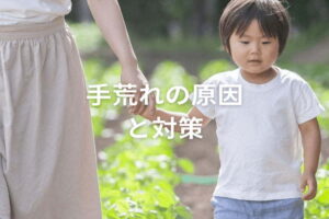 春夏も脱・手荒れ！ 手荒れの原因からハンドクリームの選び方まで徹底解説！