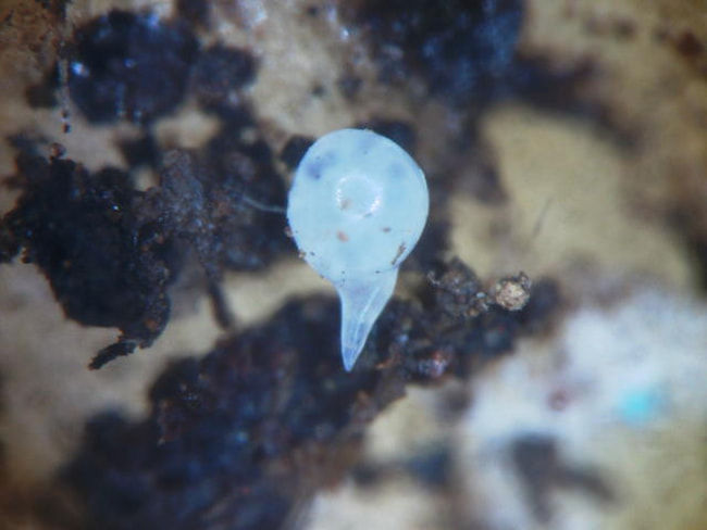 ネコブセンチュウ　雌成虫(円形部の直径0.5mm)