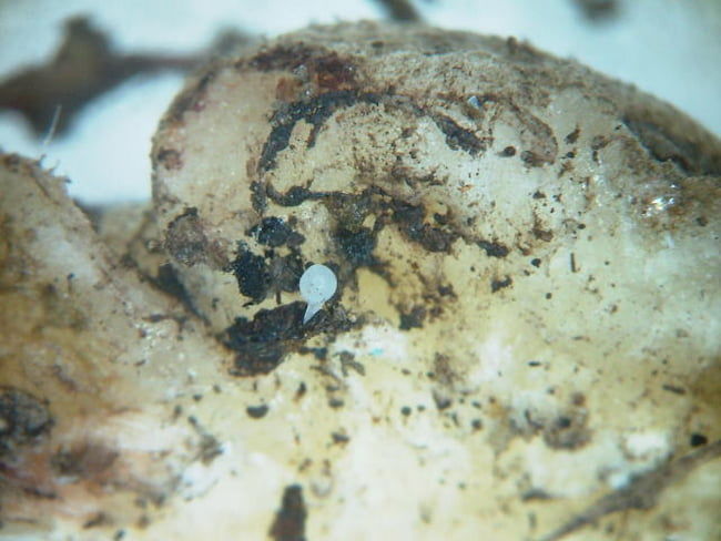 オクラ ネコブセンチュウ　根こぶ内の雌成虫(円形部の直径0.5mm)