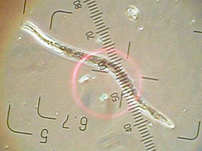 ネグサレセンチュウ(体長0.55mm)