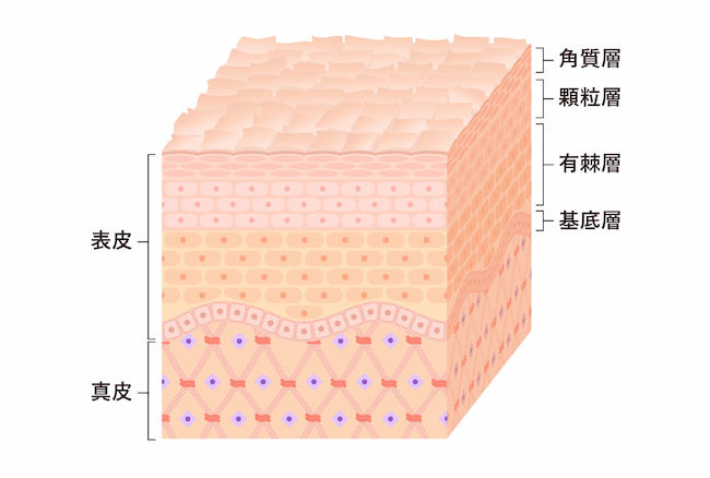 肌の構造 角質層が乾燥や摩擦によって乱れている状態